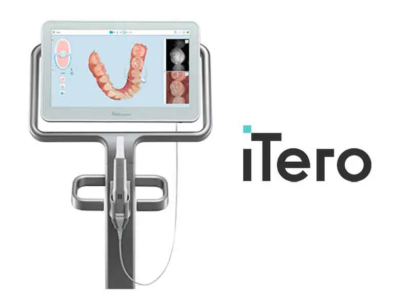 歯や歯並びをスキャンして歯の情報を読み込む機械です。肉眼では発見しづらい虫歯を検知する機能もあります